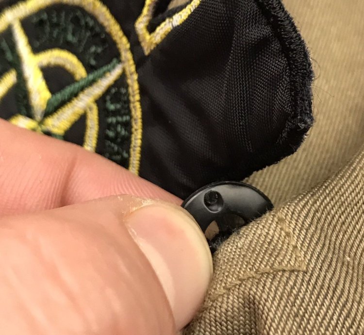 Stone Island Vintage 2 In 1 Parkas