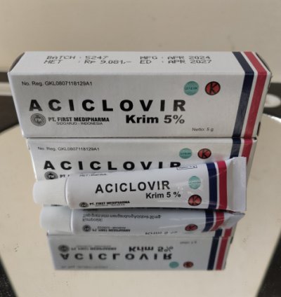 Aciclovir Cream 5g Fast-acting Antiviral Ointment For Herpes Cold Sores Chickenpox