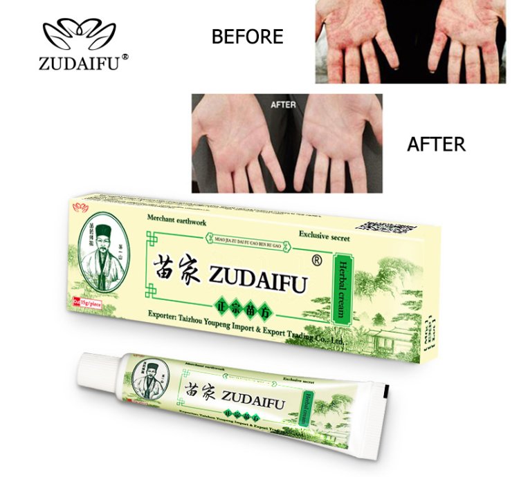 Zudaifu Herbal Cream